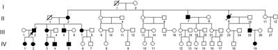 The observation of anterior segment in children with an R124L mutation corneal dystrophy by anterior segment optical coherence tomography and in vivo confocal microscopy
